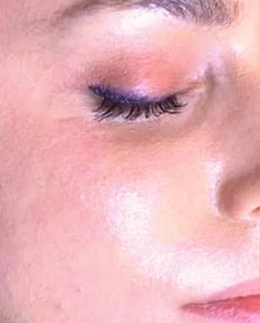 Close-up of the under-eye area