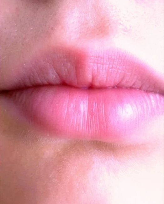 Soft, natural-looking lips