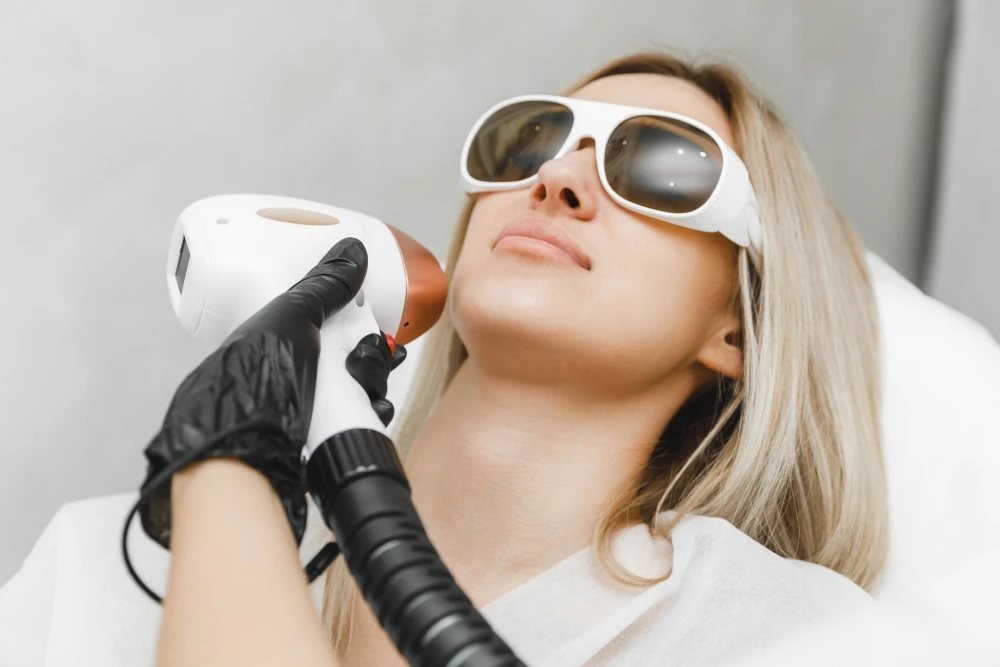 Upper lip laser hair removal at Laser & More Clinic