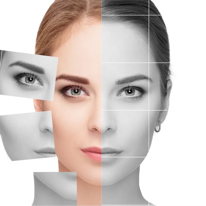 Face-mapping skin analysis used to plan acne treatment in Dubai